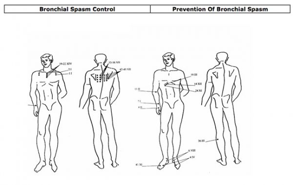 puntos de aplicación